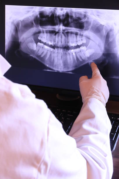 Best Root Canal Emergency Dentist  in Black Diamond, WA