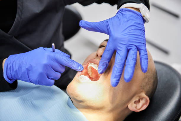 Best Chipped Tooth Repair Near Me  in Black Diamond, WA